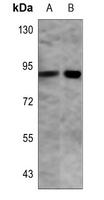 PFKP Antibody