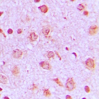 PFKP Antibody