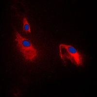 PFKP Antibody