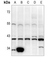 Pepsinogen C Antibody