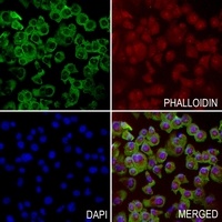 Anti-Pepsinogen C Antibody