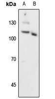 Progesterone Receptor (Phospho-S294) Antibody