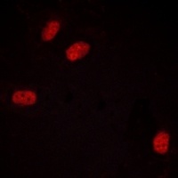 PGR (phospho-S294) antibody