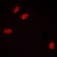 Progesterone Receptor (Phospho-S294) Antibody