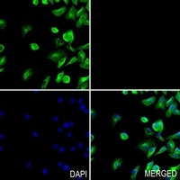 Anti-PHKG1 Antibody