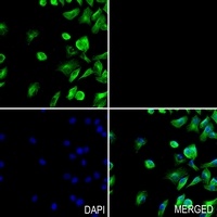 PHKG1 antibody