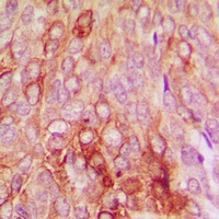 Anti-Serpin B5 Antibody