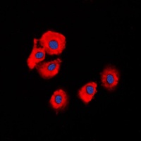 SERPINB5 antibody