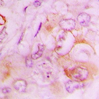 Anti-Serpin B9 Antibody