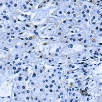 PI3K p110 delta Antibody