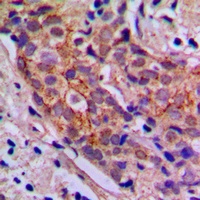 Anti-PI3K p85 alpha/p55 gamma Antibody