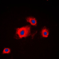 Anti-PI3K p85 alpha/p55 gamma Antibody
