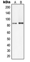 PI3K p85 beta Rabbit Polyclonal Antibody