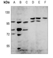 PI3K p85 beta Rabbit Polyclonal Antibody