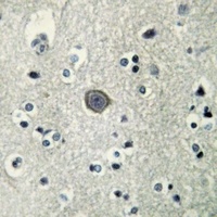 PLC beta 3 (Phospho-S537) Antibody