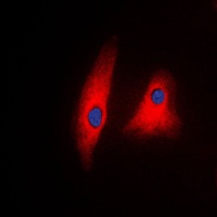 PLC gamma 1 Antibody