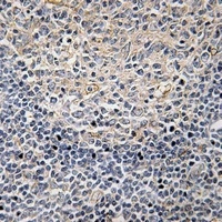 Anti-PLC gamma 2 (Phospho-Y1217) Antibody