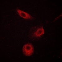 PLC gamma 2 (phospho-Y1217) antibody