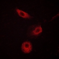 Anti-PLC gamma 2 (Phospho-Y1217) Antibody