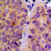 Anti-PLC gamma 2 (Phospho-Y753) Antibody
