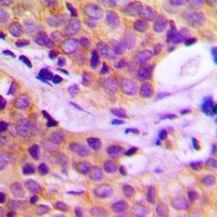 PLC gamma 2 Antibody