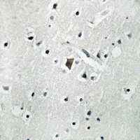 Anti-Phospholipase D2 (Phospho-Y169) Antibody