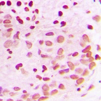 Anti-PML Antibody