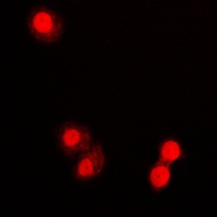 PML antibody