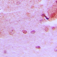Anti-PMS1 Antibody