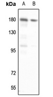 DNA Polymerase alpha 1 Rabbit Polyclonal Antibody