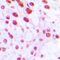 Anti-DNA Polymerase beta Antibody