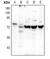 OCT2 Rabbit Polyclonal Antibody