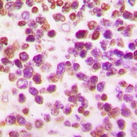 Anti-OCT2 Antibody