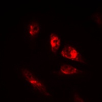 Anti-OCT2 Antibody