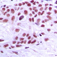 Anti-TRAP220 Antibody