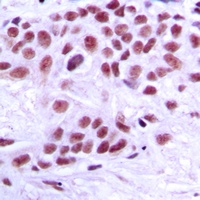 MED1 antibody