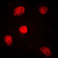 MED1 antibody