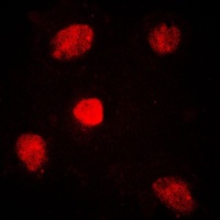 Anti-TRAP220 Antibody