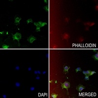 CTSA antibody