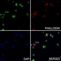 Anti-ARD1 Antibody