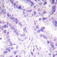 Anti-PPP2CA (Phospho-Y307) Antibody
