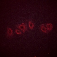 Anti-PPP2CA (Phospho-Y307) Antibody