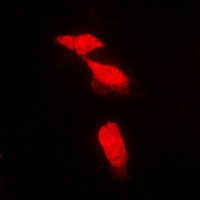 Anti-PPP2R5A Antibody