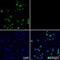 Anti-AMPK alpha 1/2 Antibody