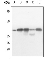 AMPK beta 1 (Phospho-S182) Antibody