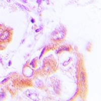 AMPK beta 1 (Phospho-S182) Antibody
