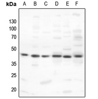 PKA C alpha/beta Antibody