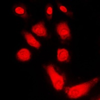 Anti-PKA C alpha/beta/gamma Antibody