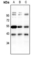 PKA C beta Rabbit Polyclonal Antibody