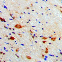 PKA C beta Rabbit Polyclonal Antibody